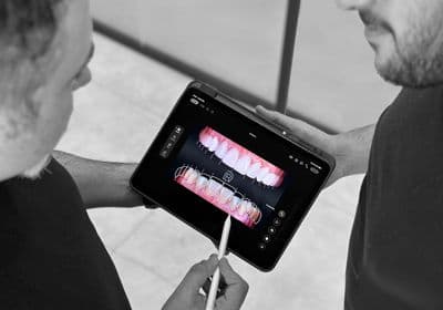 3: Tooth Preparation