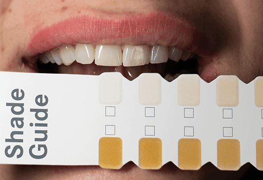 4: Herstellung von Zirkonkronen