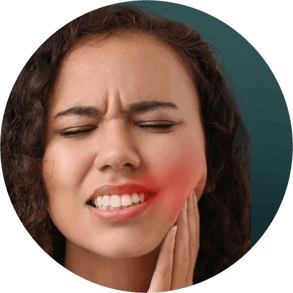 Wisdom Tooth3.png