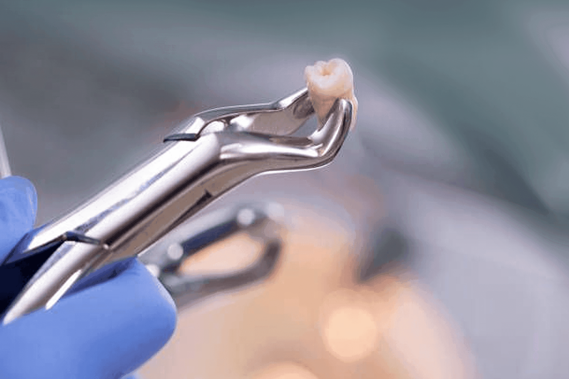 Wisdom Tooth2.png