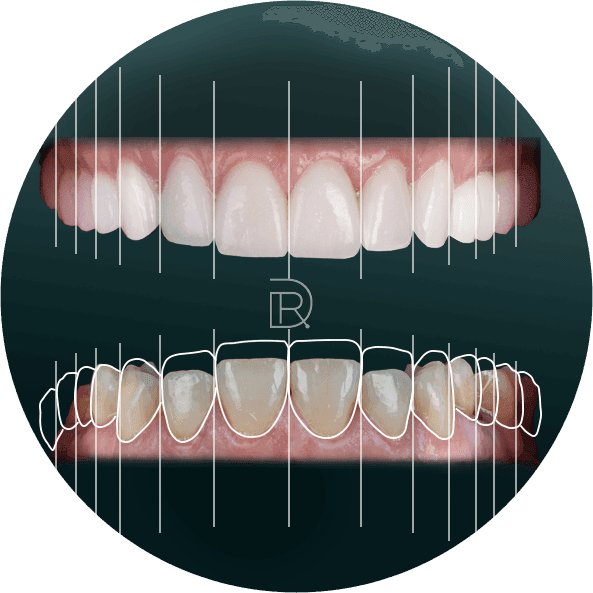 Smile Makeover.png